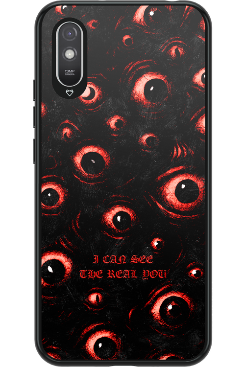 The Watchers - Xiaomi Redmi 9A