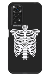 SKELETON - Xiaomi Redmi Note 11/11S 4G