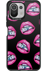 Money Lips - Xiaomi Mi 11 Lite (2021)
