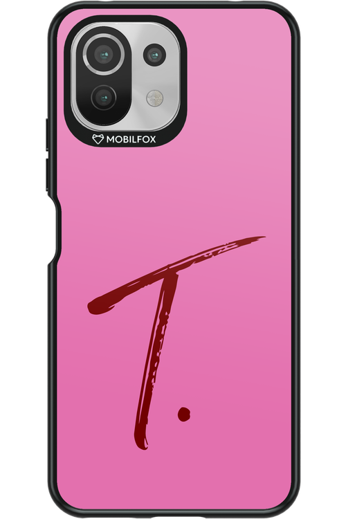(Sorbet) T 2.0 - Xiaomi Mi 11 Lite (2021)