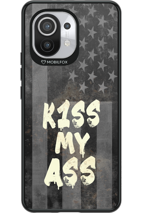 KISS II 2.0 - Xiaomi Mi 11 5G