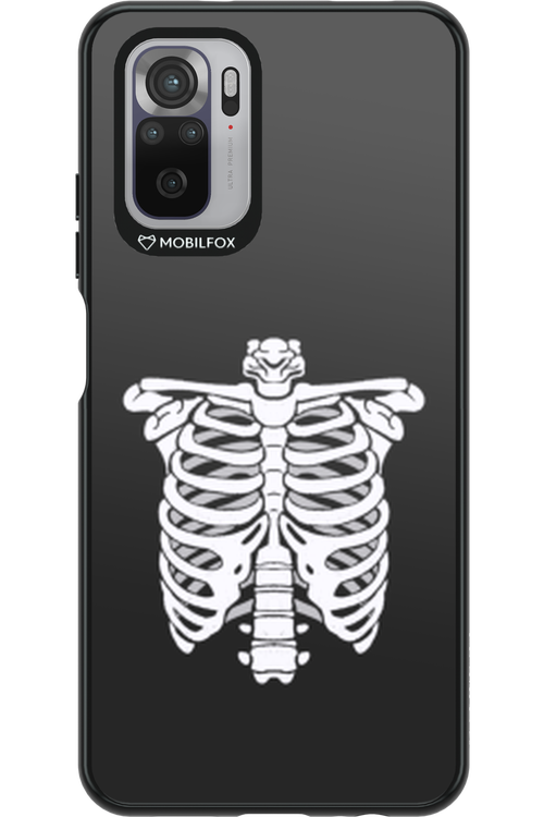 SKELETON - Xiaomi Redmi Note 10