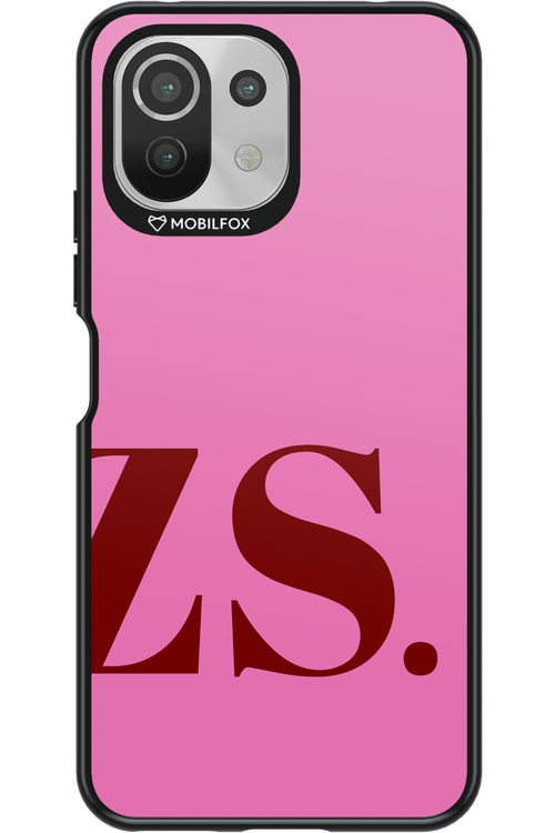 ZS (Sorbet) 2.0 - Xiaomi Mi 11 Lite (2021)