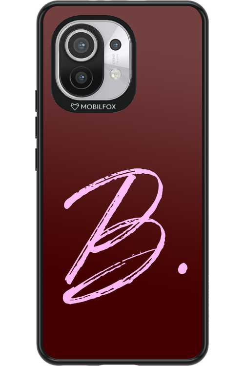 (Dark Blush) B 2.0 - Xiaomi Mi 11 5G