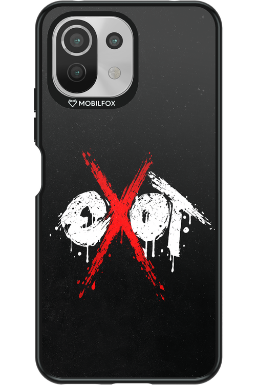 EXOT BLACK 2.0 - Xiaomi Mi 11 Lite (2021)