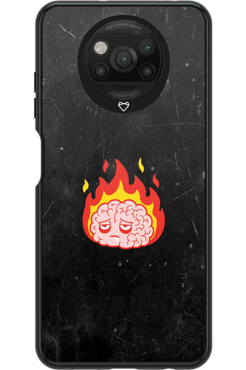 My brain - Xiaomi Poco X3 NFC
