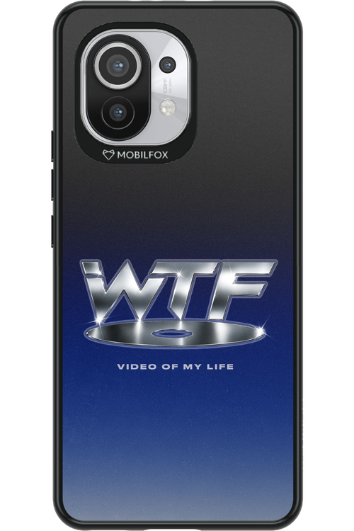 W T F 2.0 - Xiaomi Mi 11 5G