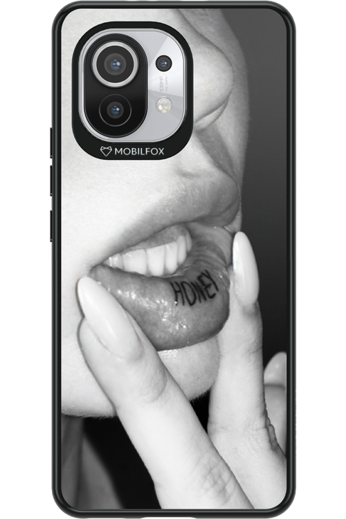 Lip Secret 2.0 - Xiaomi Mi 11 5G