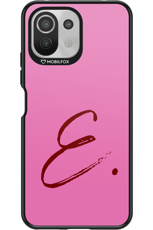 (Sorbet) E 2.0 - Xiaomi Mi 11 Lite (2021)