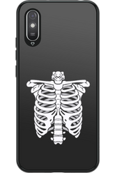 SKELETON - Xiaomi Redmi 9A