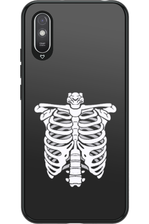 SKELETON - Xiaomi Redmi 9A