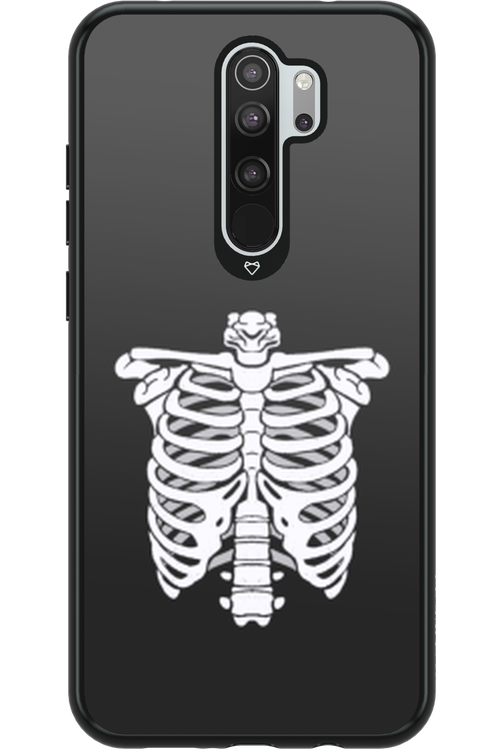 SKELETON - Xiaomi Redmi Note 8 Pro