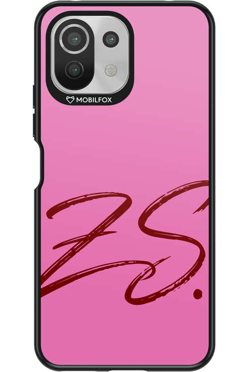 (Sorbet) ZS 2.0 - Xiaomi Mi 11 Lite (2021)