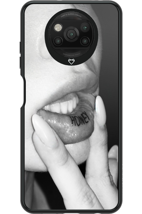 Lip Secret 2.0 - Xiaomi Poco X3 NFC