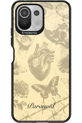 Paranoid (Sand) - Xiaomi Mi 11 Lite (2021)