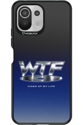 W T F 2.0 - Xiaomi Mi 11 Lite (2021)