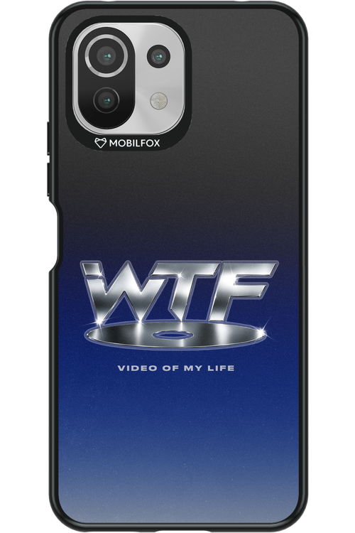 W T F 2.0 - Xiaomi Mi 11 Lite (2021)