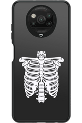 SKELETON - Xiaomi Poco X3 NFC