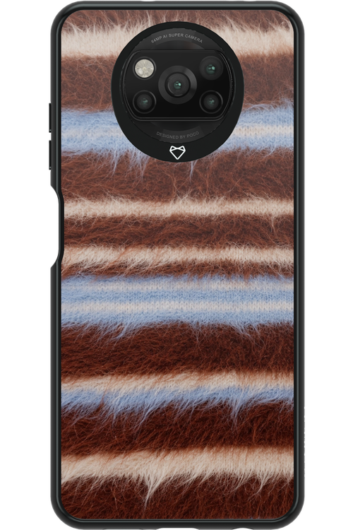 Soft Spot 2.0 - Xiaomi Poco X3 Pro