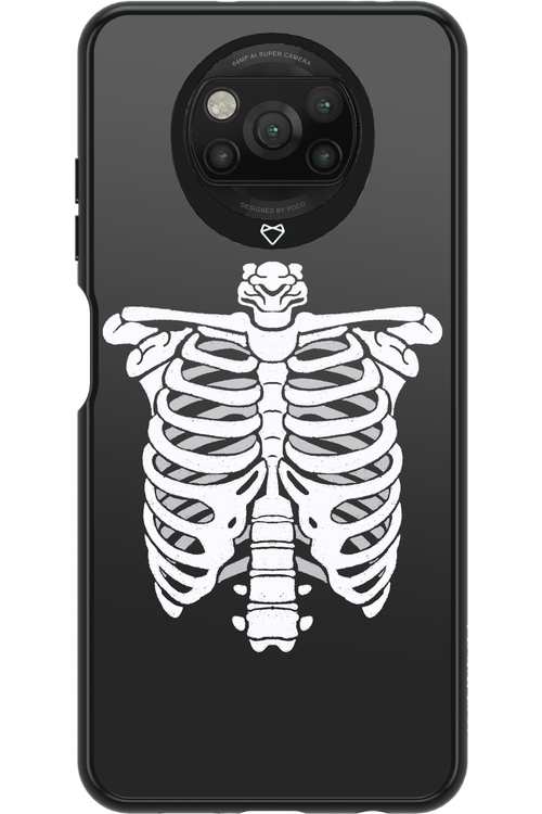 SKELETON - Xiaomi Poco X3 Pro