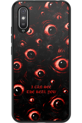 The Watchers - Xiaomi Redmi 9A