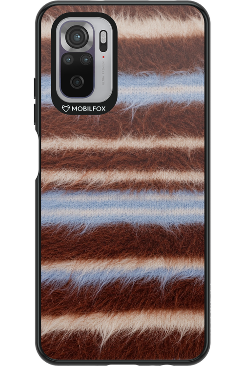 Soft Spot 2.0 - Xiaomi Redmi Note 10