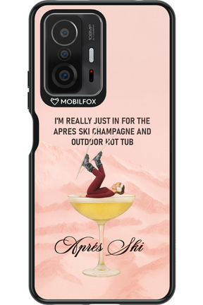 Champagne Tub - Xiaomi Mi 11T Pro