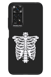 SKELETON - Xiaomi Redmi Note 11/11S 4G