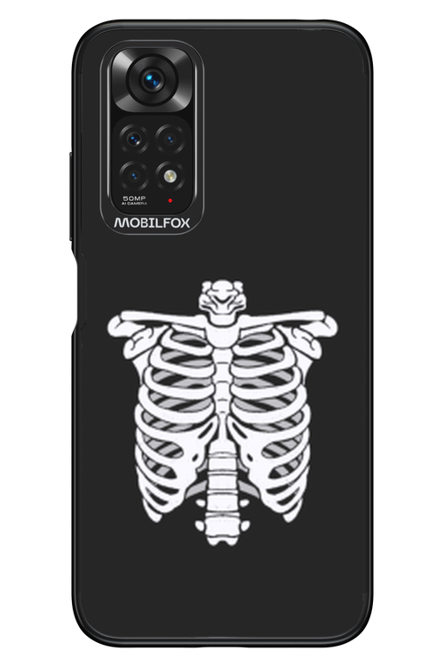 SKELETON - Xiaomi Redmi Note 11/11S 4G