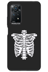 SKELETON - Xiaomi Redmi Note 11Pro 4G/5G