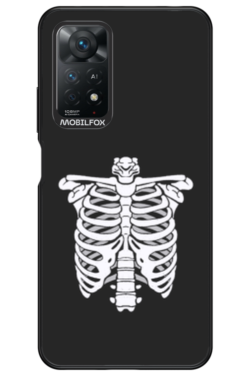 SKELETON - Xiaomi Redmi Note 11Pro 4G/5G