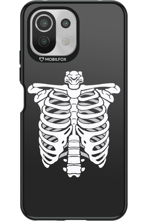 SKELETON - Xiaomi Mi 11 Lite (2021)