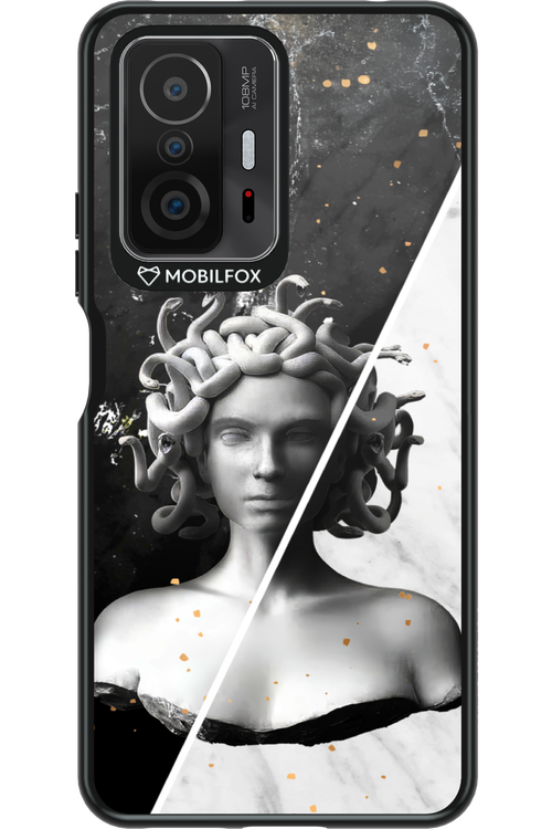 Medusa - Xiaomi Mi 11T