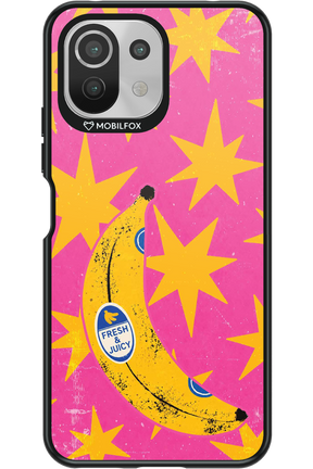 BANANA POP 2.0 - Xiaomi Mi 11 Lite (2021)