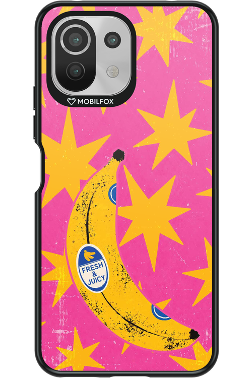 BANANA POP 2.0 - Xiaomi Mi 11 Lite (2021)