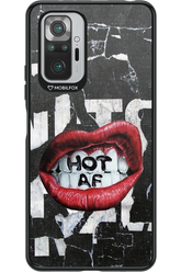 HOT AS F - Xiaomi Redmi Note 10S