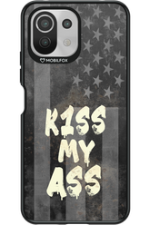 KISS II 2.0 - Xiaomi Mi 11 Lite (2021)