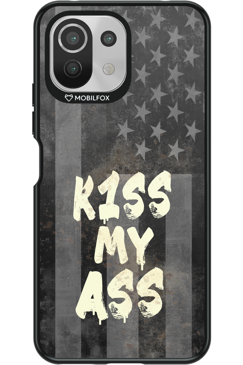 KISS II 2.0 - Xiaomi Mi 11 Lite (2021)