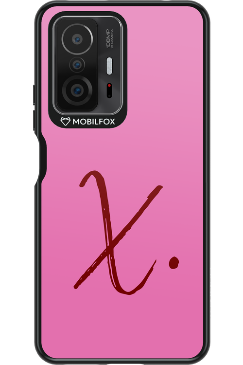 (Sorbet) X 2.0 - Xiaomi Mi 11T