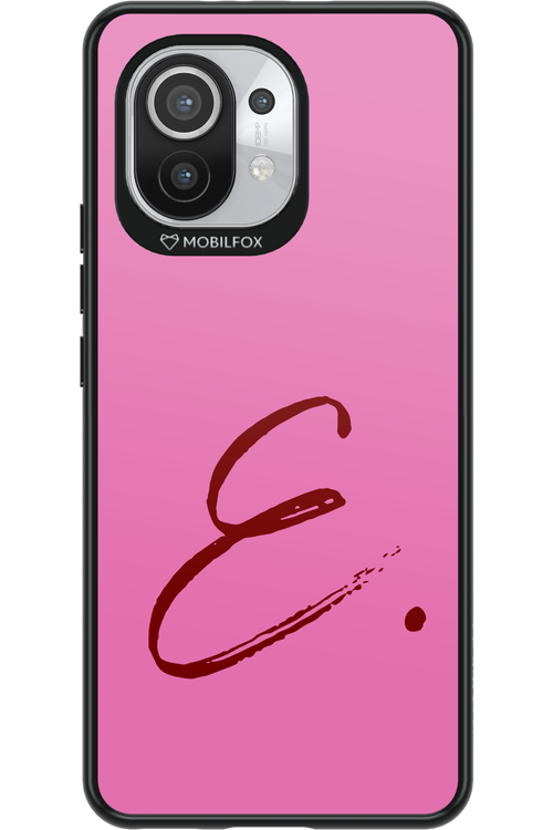 (Sorbet) E 2.0 - Xiaomi Mi 11 5G