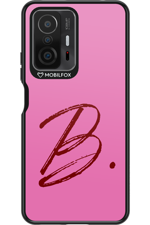 (Sorbet) B 2.0 - Xiaomi Mi 11T